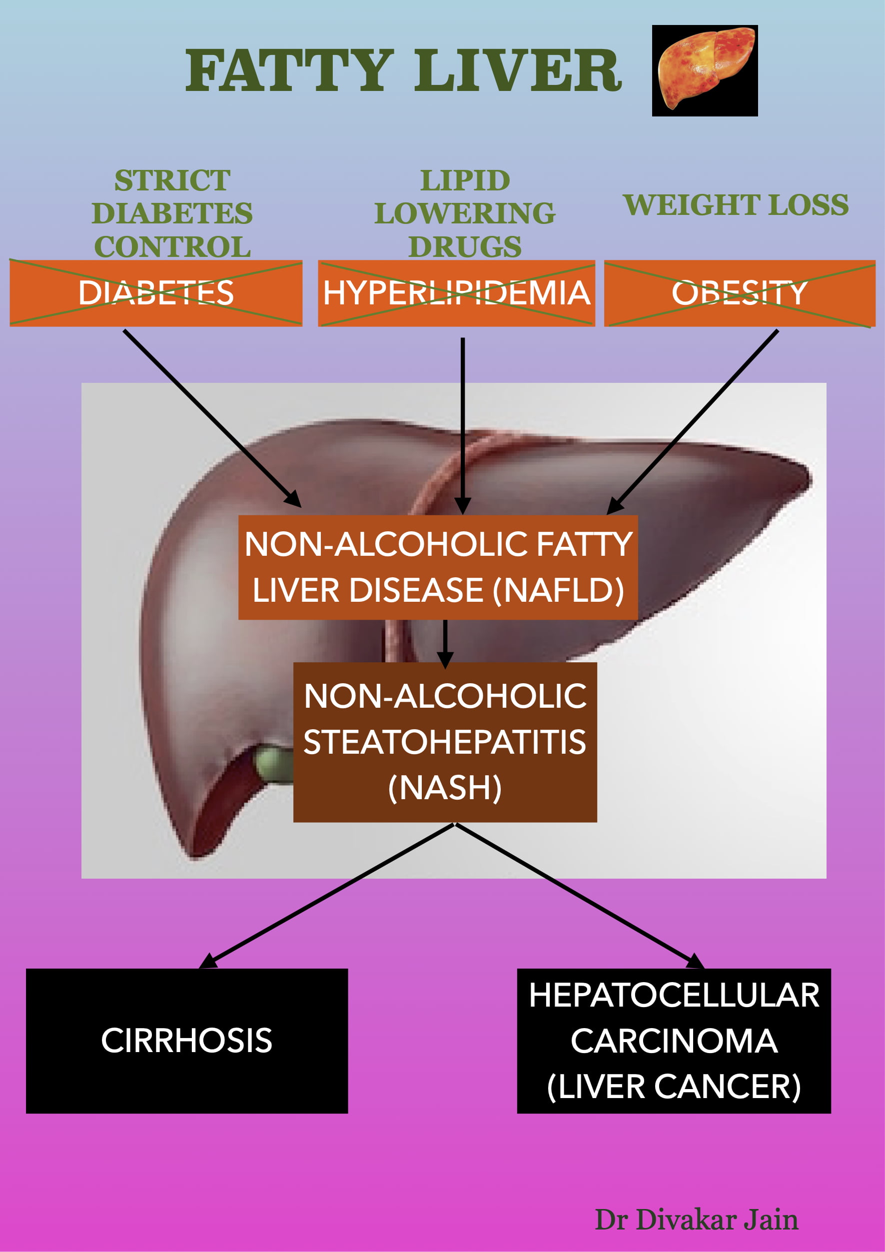 Fatty liver treatment in Ahmedabad
