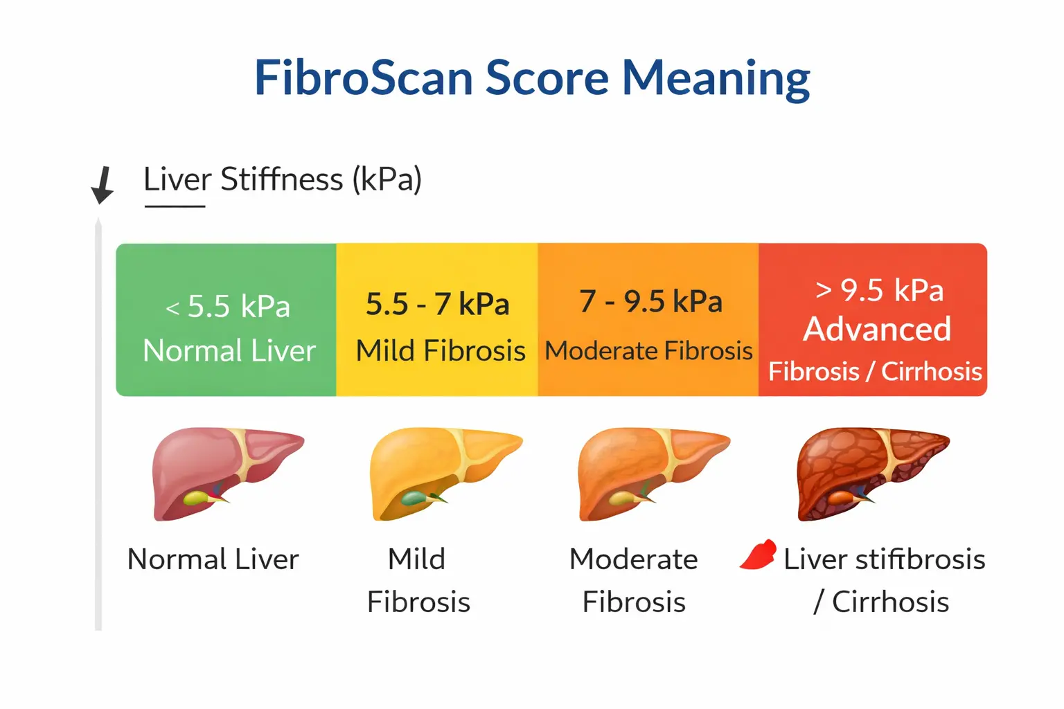fibroscan score meaning liver stiffness kpa chart