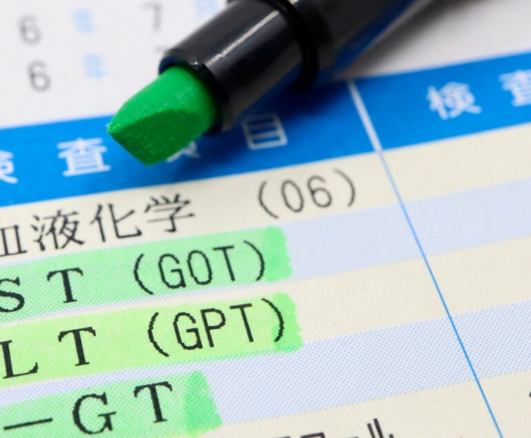 Normal liver enzymes