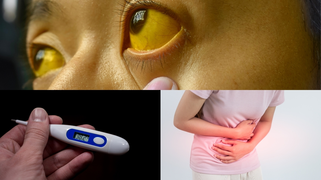 Symptoms of stones in bile duct