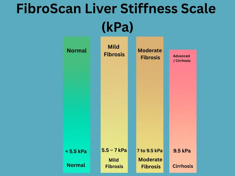 fibroscan-kpa-scale-liver-stiffness-chart.webp