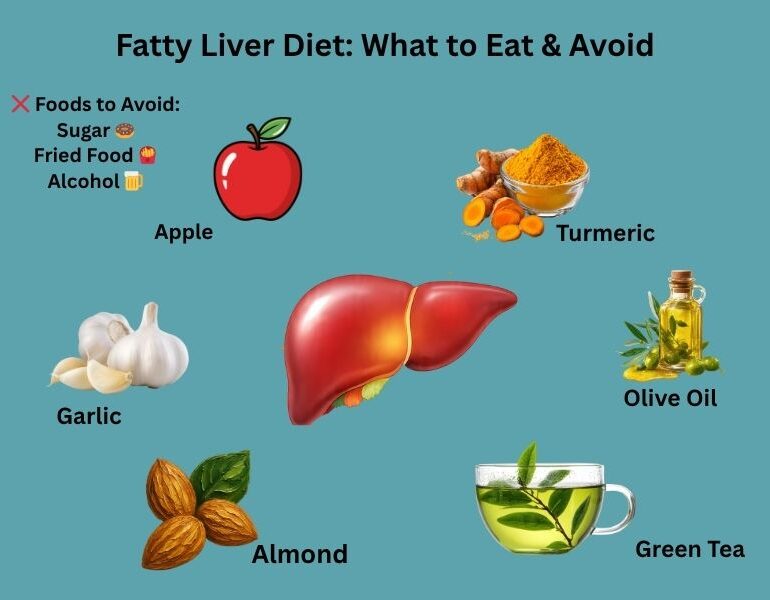 fatty liver diet foods to eat and avoid infographic