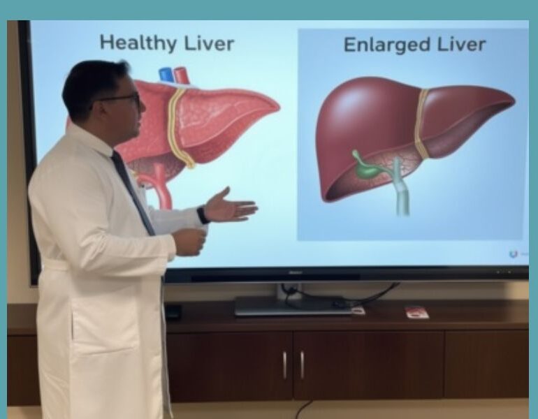 doctor explaining enlarged liver symptoms and healthy liver comparison