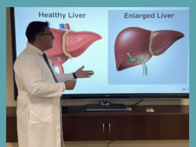 doctor explaining enlarged liver symptoms and healthy liver comparison