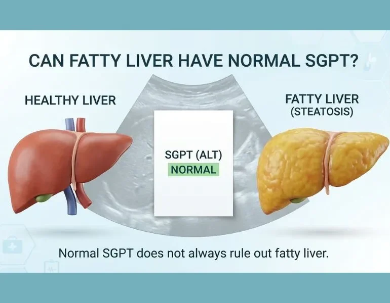 Can fatty liver have normal SGPT with healthy and fatty liver comparison