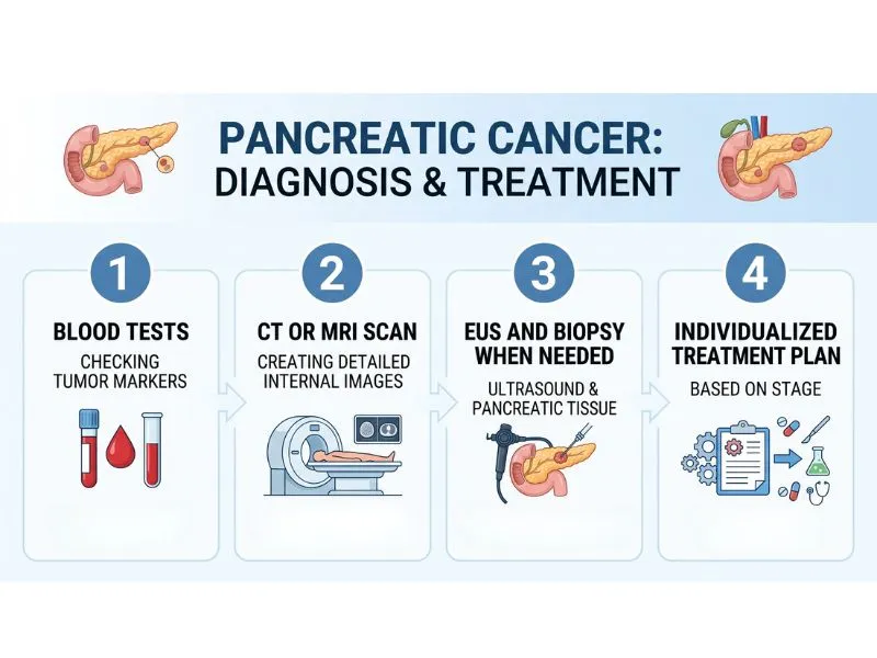 Tests and treatment planning for pancreatic cancer